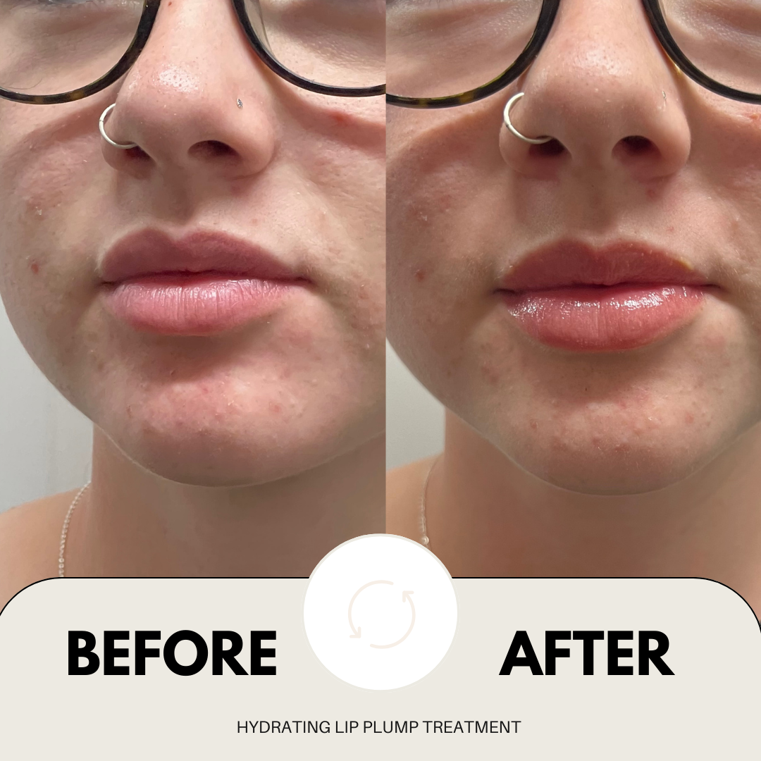 Hydrating Lip Plump Treatment (15g pot)